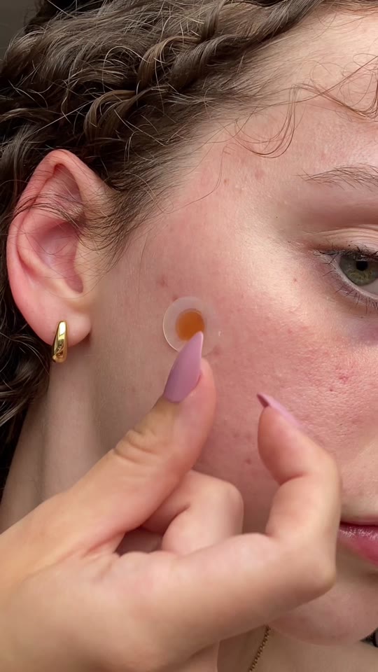 A dot on the skin