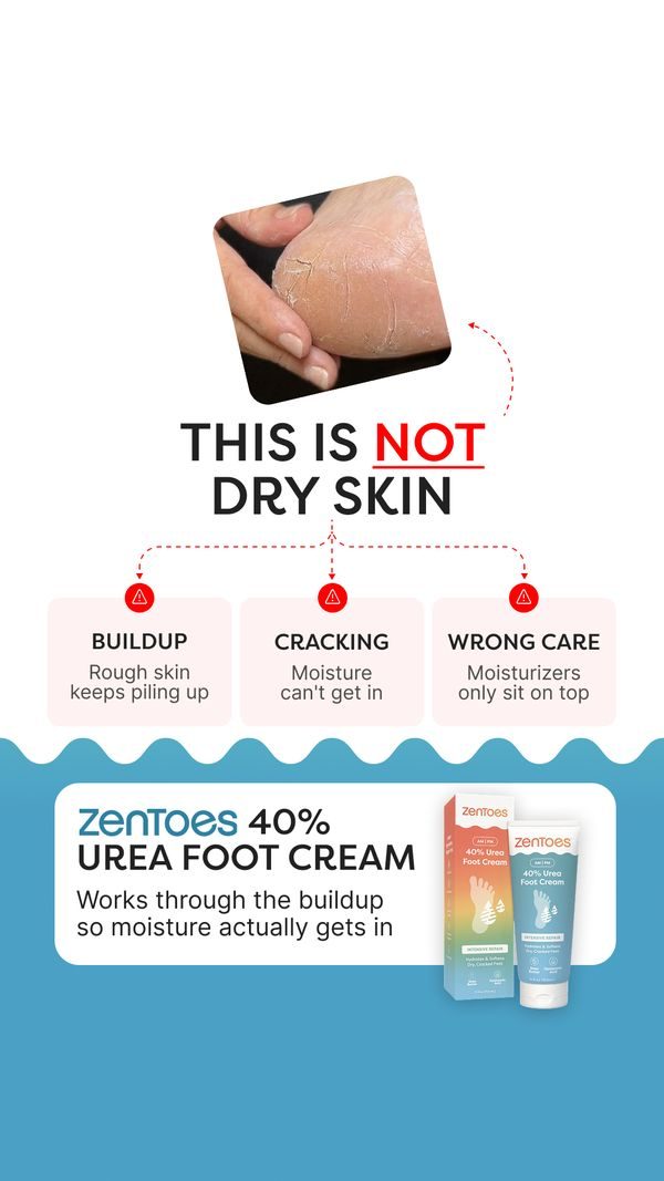 This is not dry skin, variant A