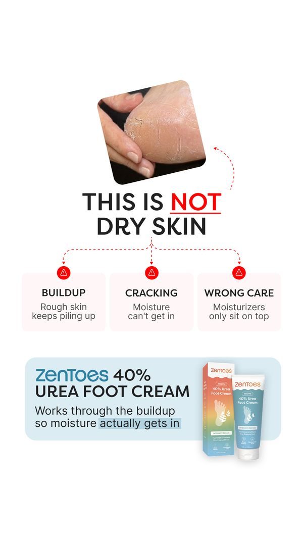 This is not dry skin, variant B
