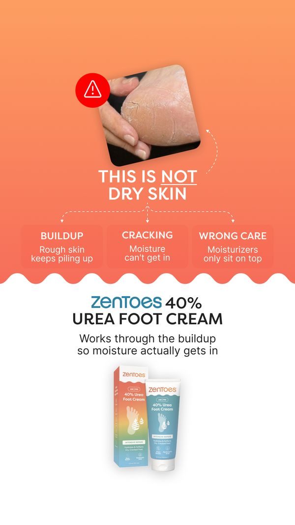 This is not dry skin, variant C