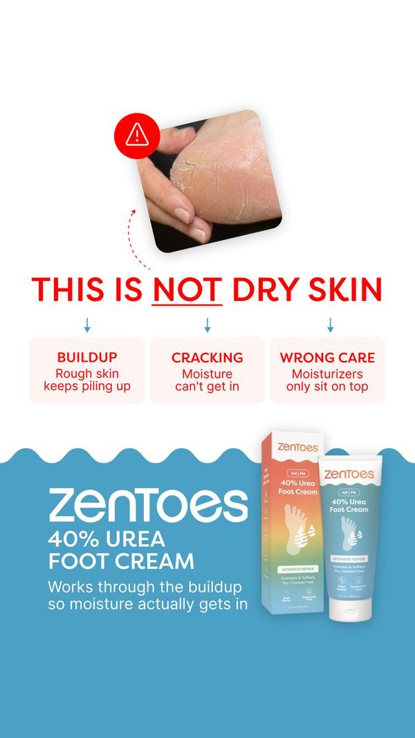 This is not dry skin, variant D